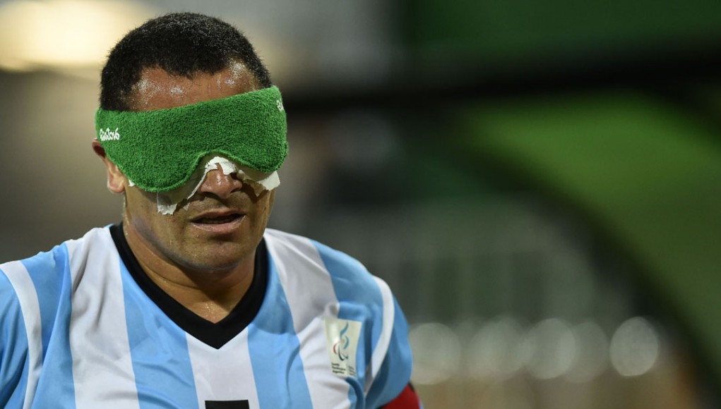 RIO DE JANEIRO, BRAZIL - SEPTEMBER 09: Silvio Velo during the Men's Football 5-a-side between Argentina and Mexico at the Olympic Tennis Centre on Day 2 of the Paralympic Games on September 9, 2016 in Rio de Janeiro, Brazil. (Photo by Bruna Prado/Getty Images)